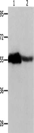 CBX2 Antibody