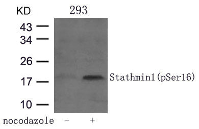 Phospho-STMN1 (Ser16) Antibody