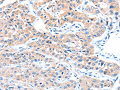 ADAM32 Antibody