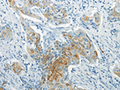 WNT8B Antibody