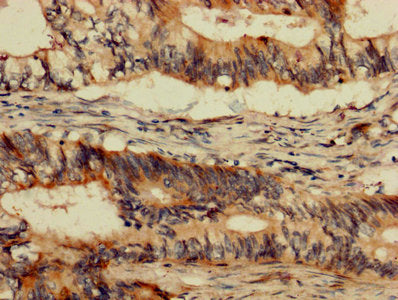 ABL1 Antibody