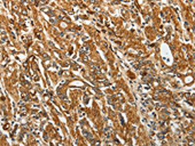 RPLP0 Antibody