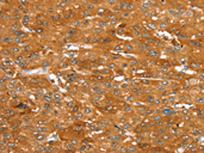 ABCC9 Antibody
