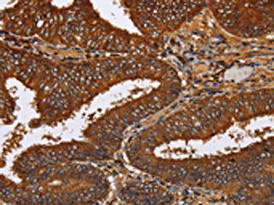 TICAM2 Antibody