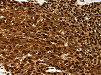 SCN1A Antibody
