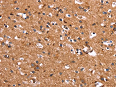 HSD17B1 Antibody