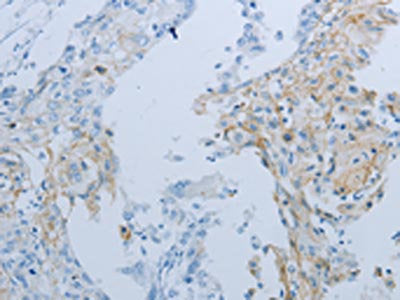 JUP Antibody