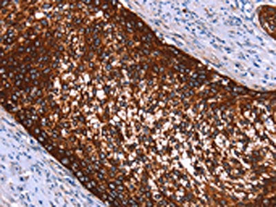 HMGCS2 Antibody