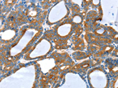 SNX5 Antibody