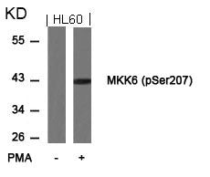 Phospho-MAP2K6 (Ser207) Antibody