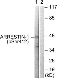 Phospho-ARRB1 (Ser412) Antibody