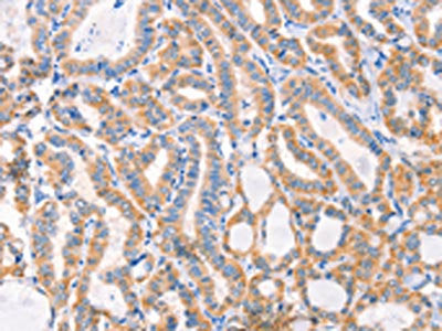 F13A1 Antibody