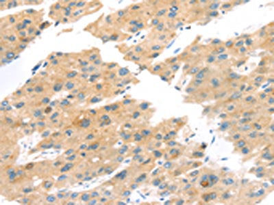 TNK1 Antibody