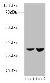 UQCRFS1 Antibody