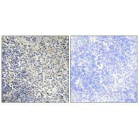TP53AIP1 Antibody