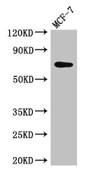 KARS Antibody