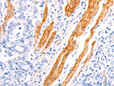 TPM1 Antibody
