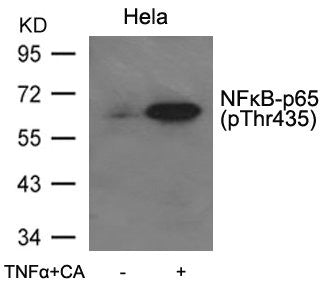 Phospho-RELA (Thr435) Antibody