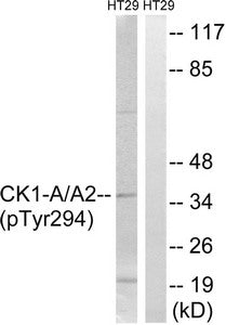 Phospho-CSNK1A1/CSNK1A1L (Tyr294) Antibody