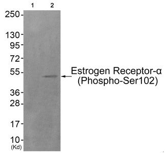 Phospho-ESR1 (Ser102) Antibody