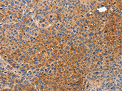 NOD1 Antibody