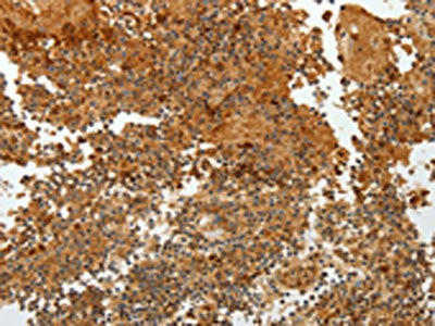 TFF2 Antibody