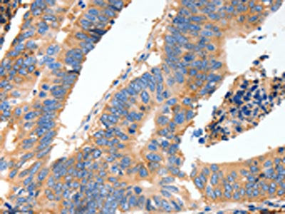 MUC6 Antibody