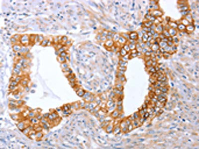 ABO Antibody