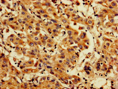 PDCD6 Antibody