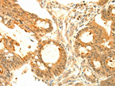 SOCS6 Antibody