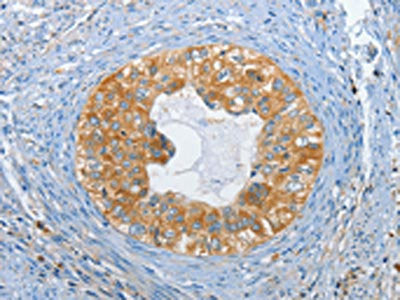 DGKZ Antibody