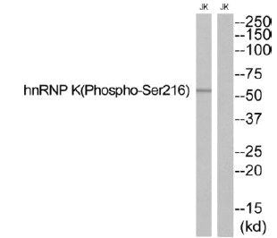 Phospho-HNRNPK (Ser216) Antibody