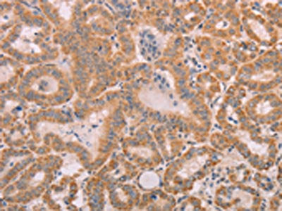 SMAD5 Antibody