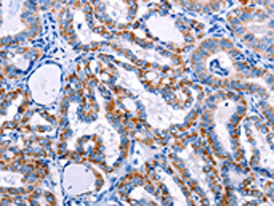 FHIT Antibody