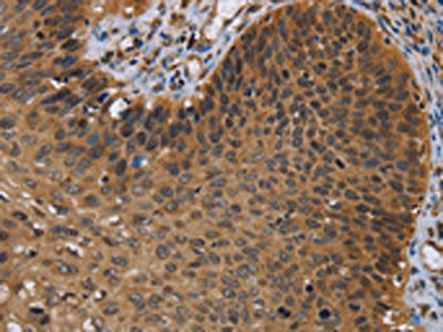 UHRF2 Antibody