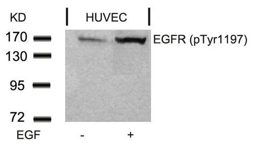 Phospho-EGFR (Tyr1197) Antibody