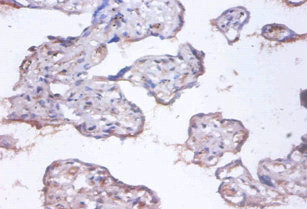 COMMD4 Antibody