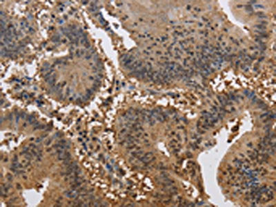 JAG2 Antibody