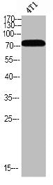 Phospho-BMX (Y566) Antibody