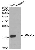 Histone H3R8me2a Antibody