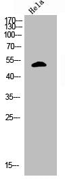 Phospho-TP53 (S366) Antibody