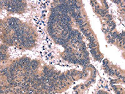 FAIM Antibody