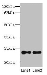 TMED2 Antibody