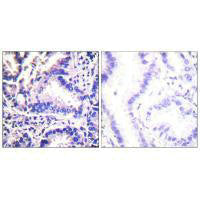SNCG Antibody