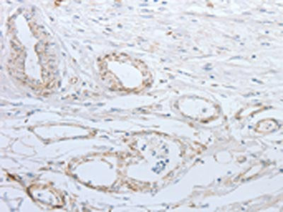 SLC5A5 Antibody