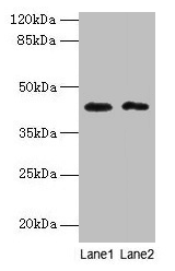 BTBD2 Antibody