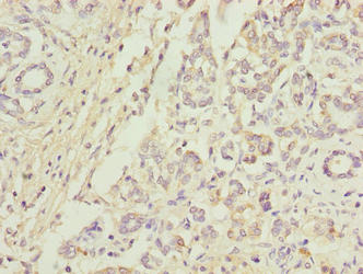 ANAPC5 Antibody