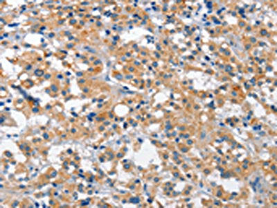 CUL7 Antibody