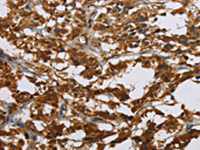 CLDN2 Antibody