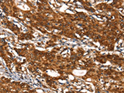 CYP2D6 Antibody